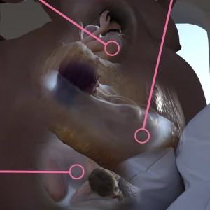 Bonding time 9 (x-ray)